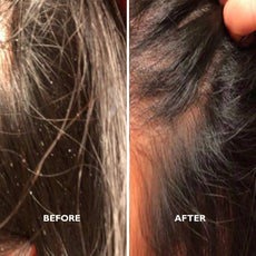 Flake-Less Advanced Kit