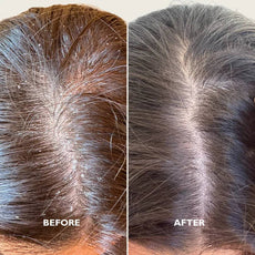 Flake-Less Advanced Kit