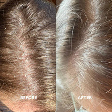 Flake-Less Advanced Kit